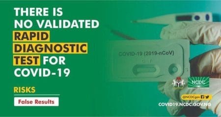 COVID-19: NCDC to increase testing laboratories, says Rapid Diagnostic Test Kit not validated NCDC