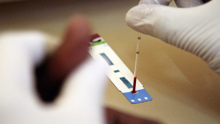 FG Partners with China Firm on Local HIV Diagnostic Kits